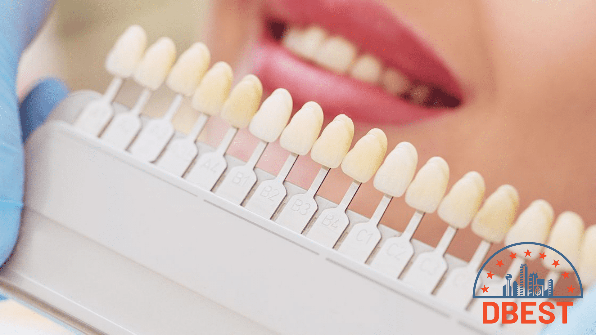 The 5 Best Teeth Whitening Clinics in Dallas Homepage