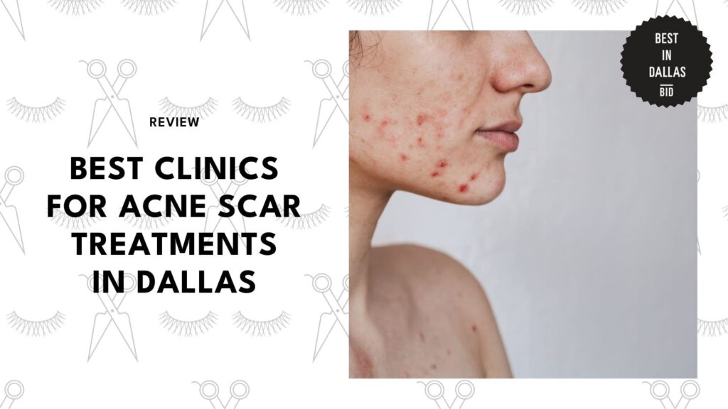 best-acne-scar-treatment-dallas